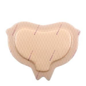 Mepilex Border Sacrum Wound Dressing, 8.7" x 9.8" (SC282455, 10/BX)